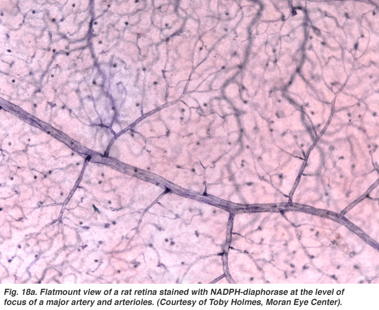 Simple Anatomy of the Retina by Helga Kolb – Webvision