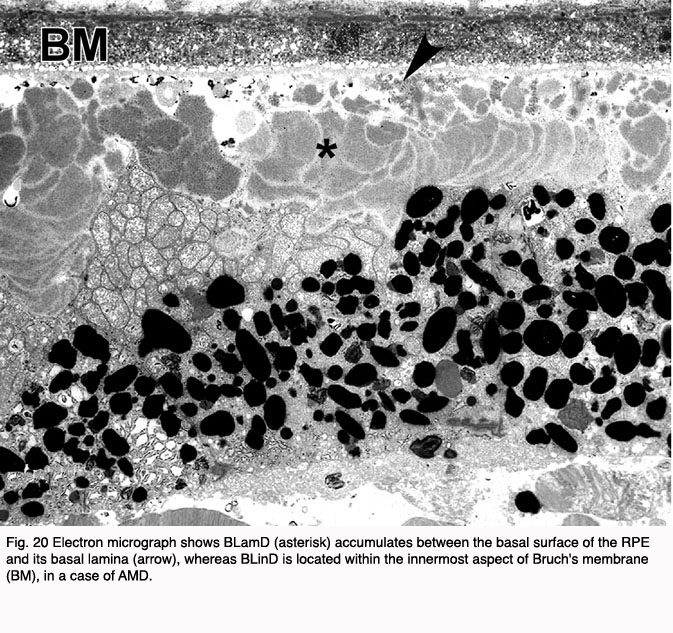 Animal Cell Electron Micrograph. 20 Electron micrograph shows