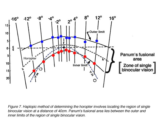 Binocular Diplopia