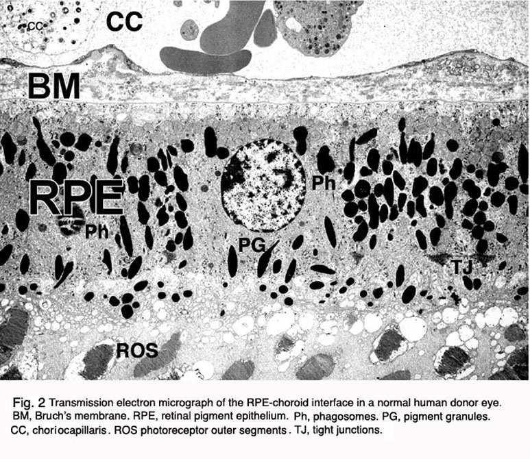 The retina and retinal pigment epithelium (RPE)