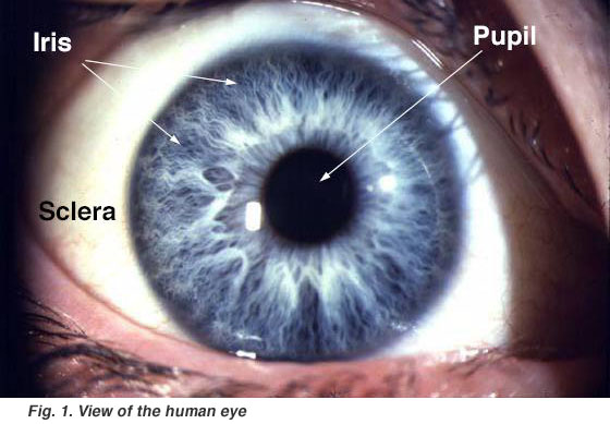 eye blood vessels photo