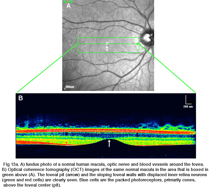 Figure 1. [The normal human retina fundus]. - Webvision - NCBI