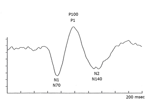 Visually Evoked Potentials by Donnell J. Creel – Webvision