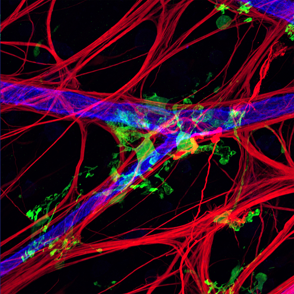 Human Retina with microglia