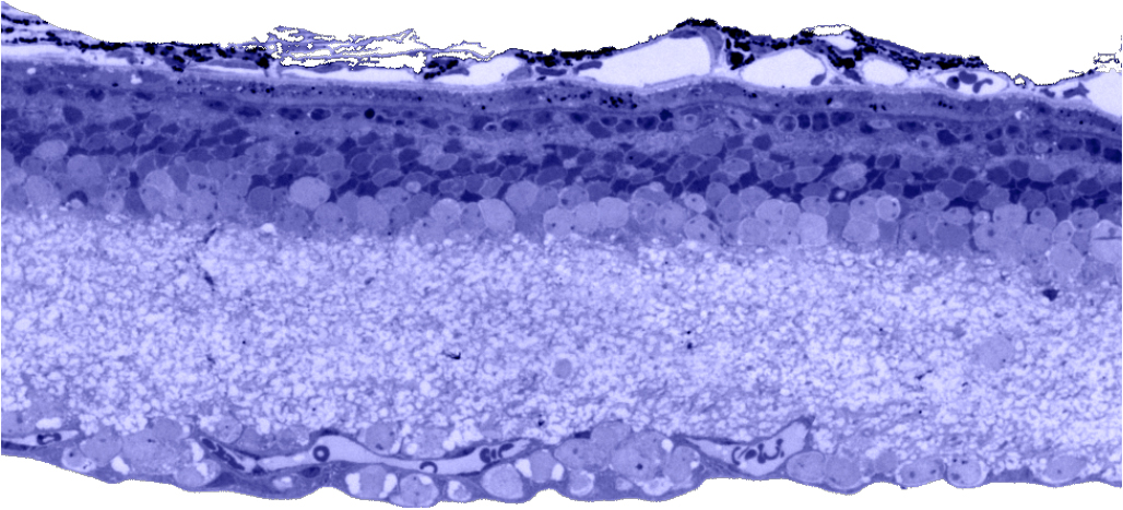 Figure 7 degenerate retina tol blue histology