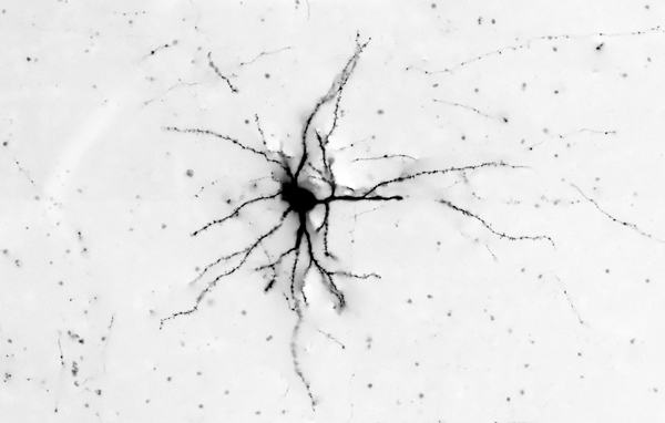 Visual-cortex-neuron
