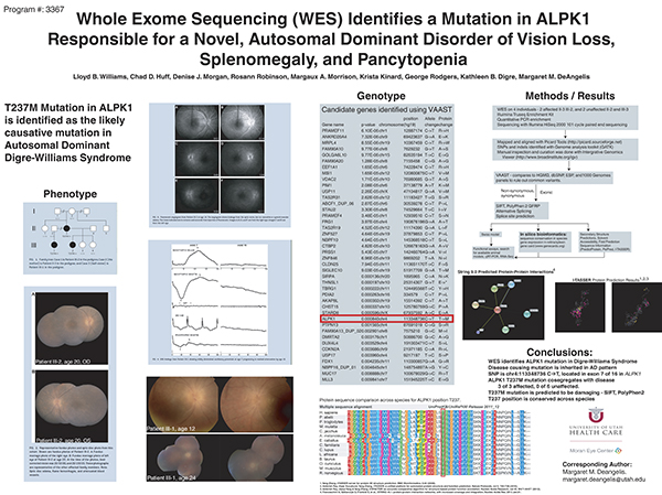 Cureus, Whole-Exome Sequencing Identified a Novel DYRK1A Variant in a  Patient With Intellectual Developmental Disorder, Autosomal Dominant 7