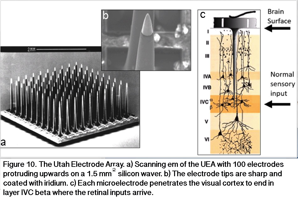 First human implantation of the WFMA for intracortical visual prosthesis -  Microprobes for Life Science