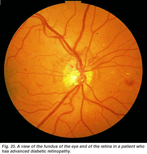 Retina: Anatomy, Function & Common Conditions