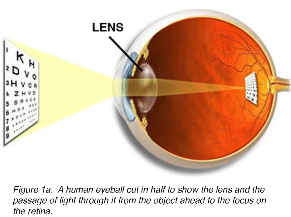 Crystalline Lens and Cataract by Joah F. Aliancy and Nick Mamalis