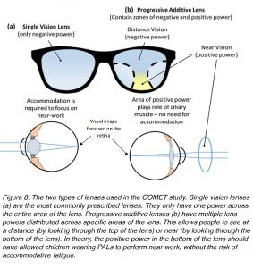 The Science Behind Myopia by Brittany J. Carr and William K. Stell ...