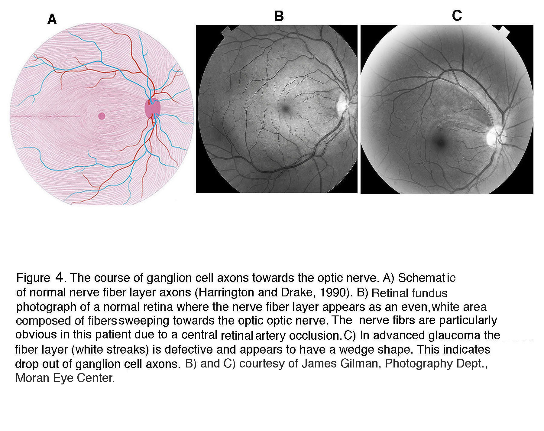 Figure 1. [The normal human retina fundus]. - Webvision - NCBI