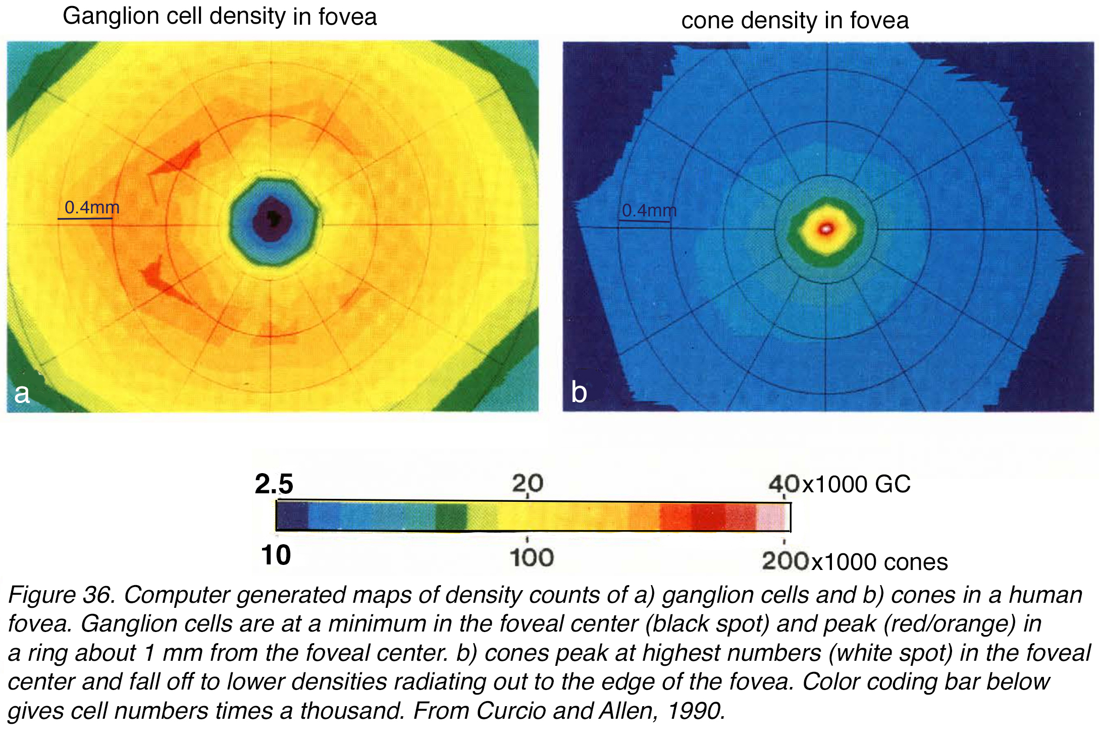 What is the fovea? – Front Range Retina